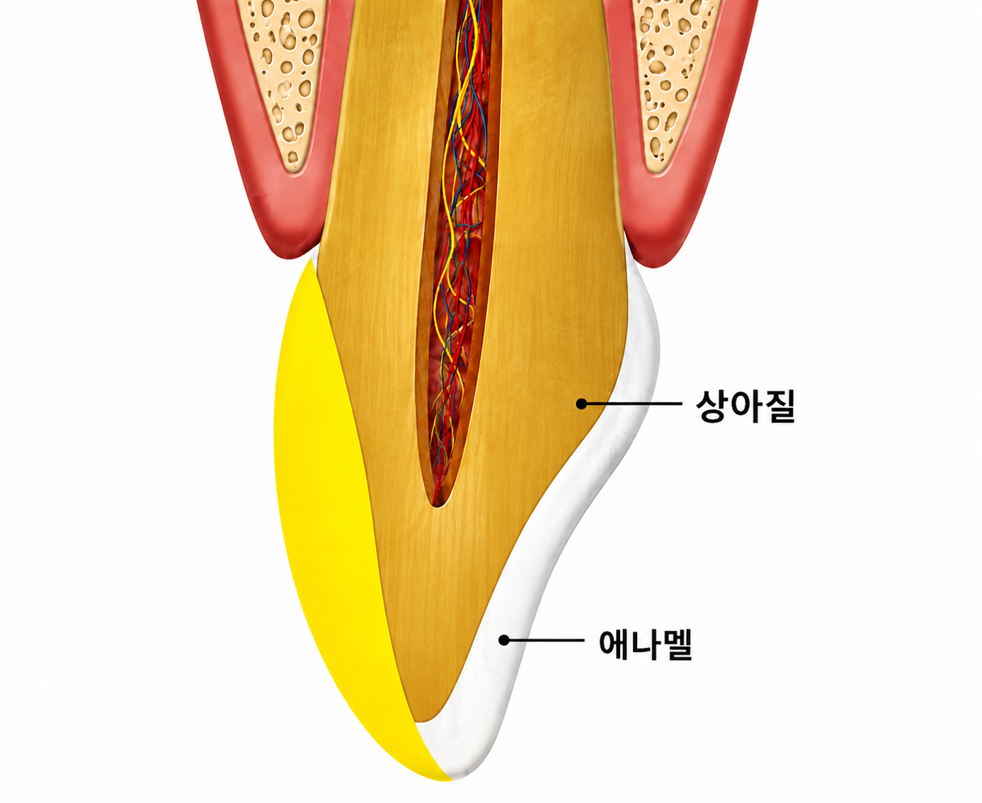 일반 라미네이트